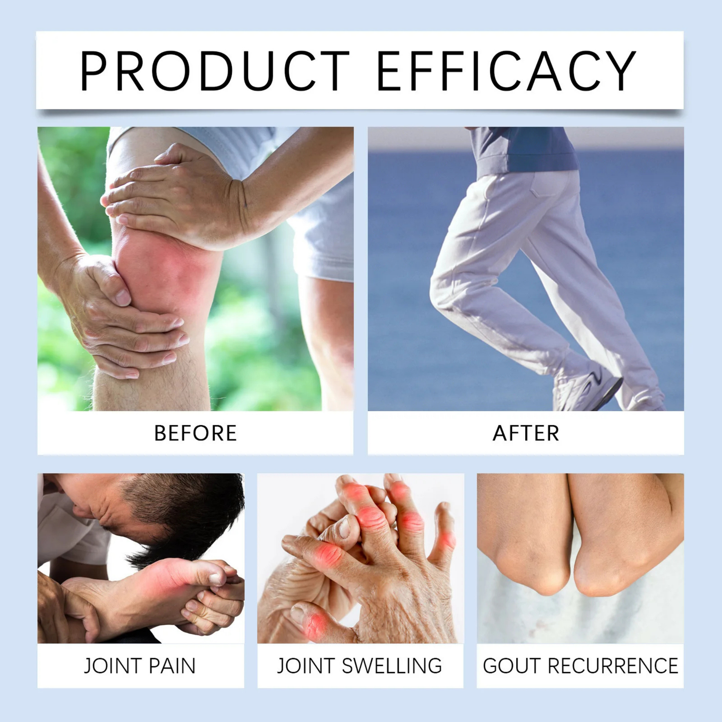 Premium 20g Gout Relief Ointment - Targeted Natural Pain Management Formula
